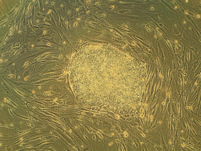 Stem cells Stem cells