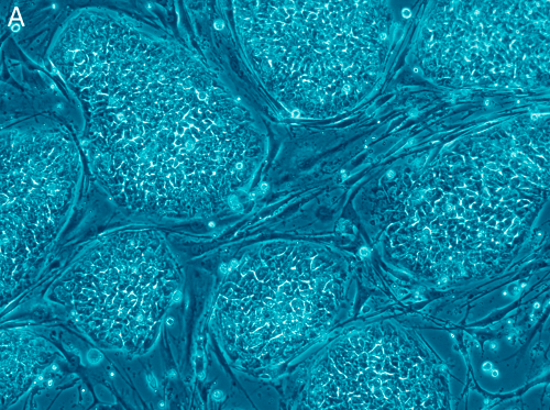 Human embryonic stem cells. Image credit: Nissim Benvenisty via Wikicommons Human embryonic stem cells. Image credit: Nissim Benvenisty via Wikicommons